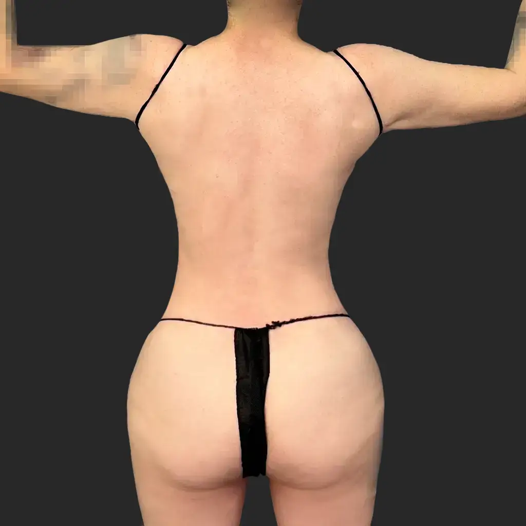 Additional after image