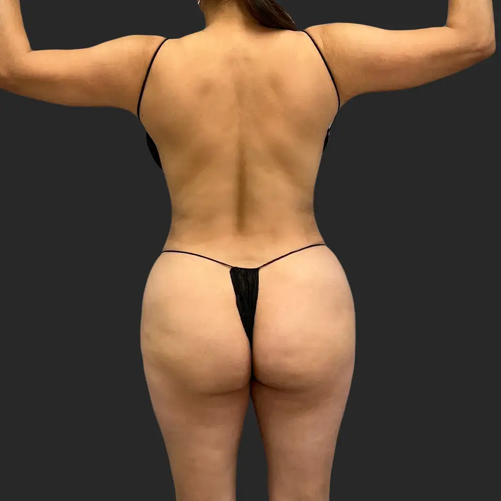 Additional after image