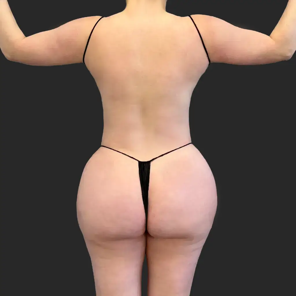 Additional after image