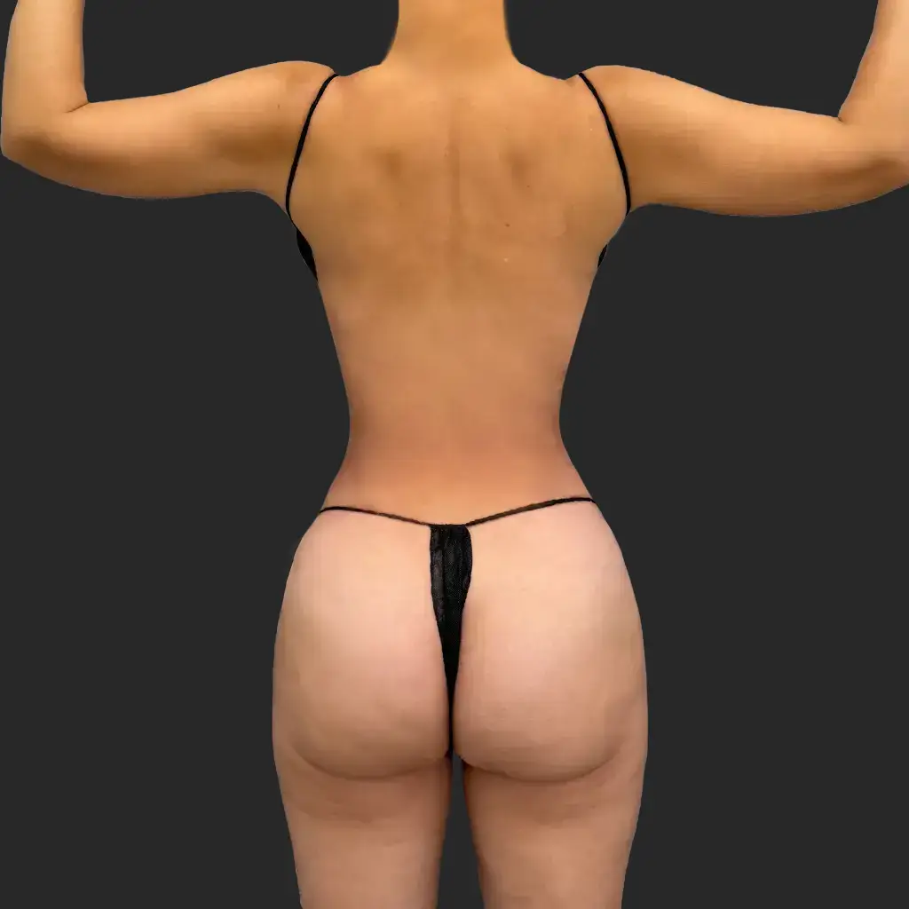 Additional after image