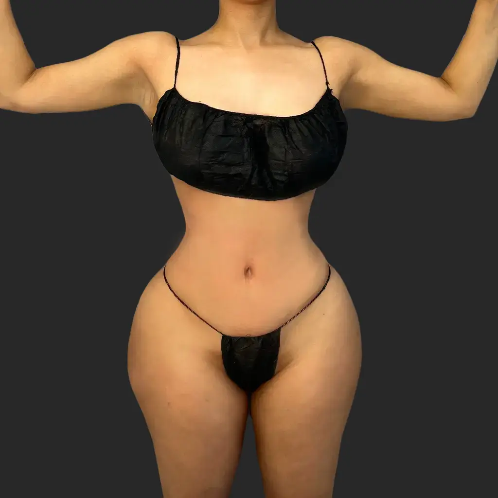 Additional after image