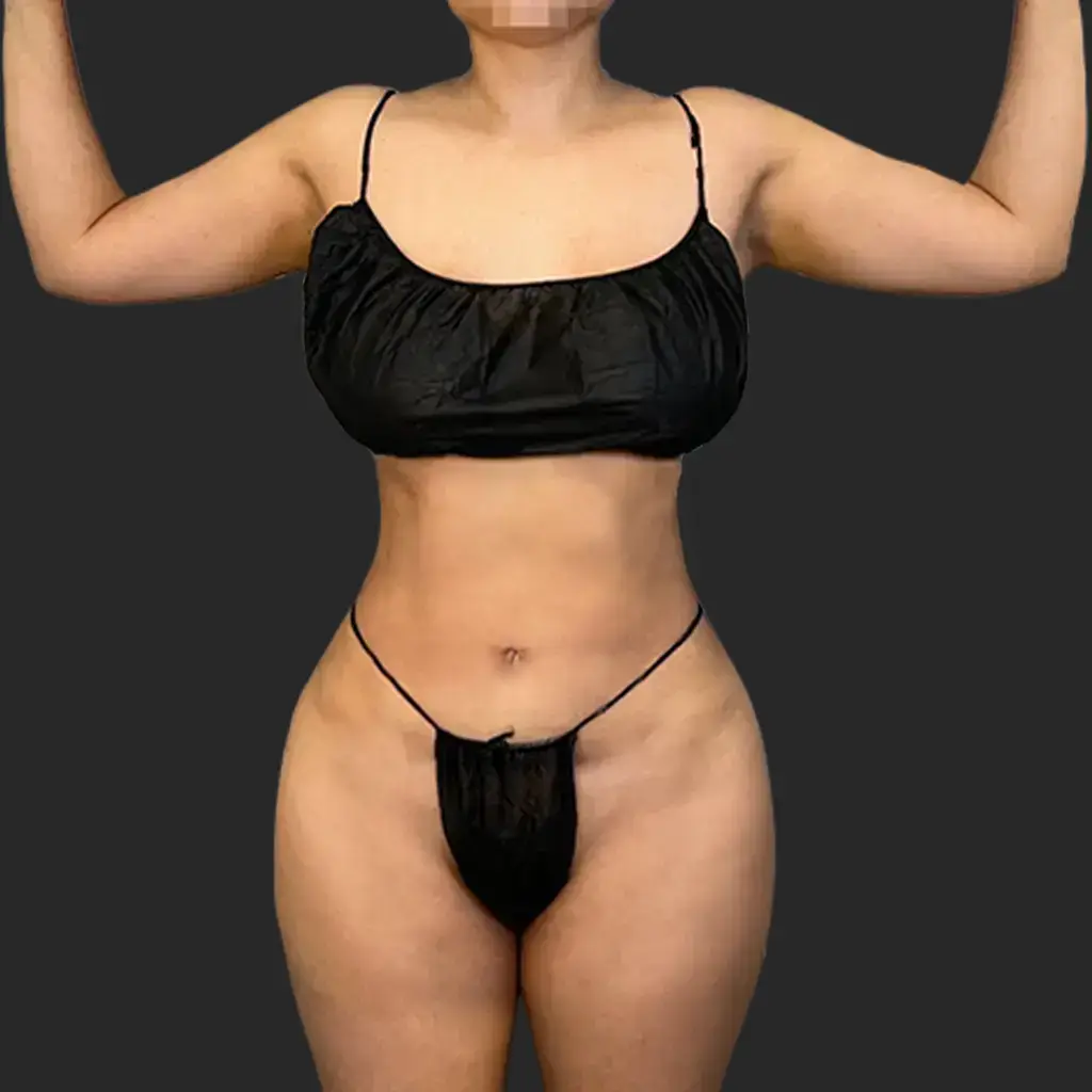 Additional after image