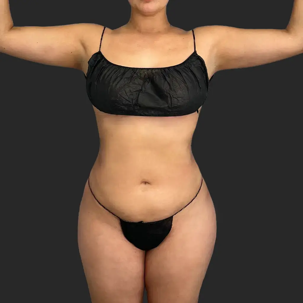 Additional after image