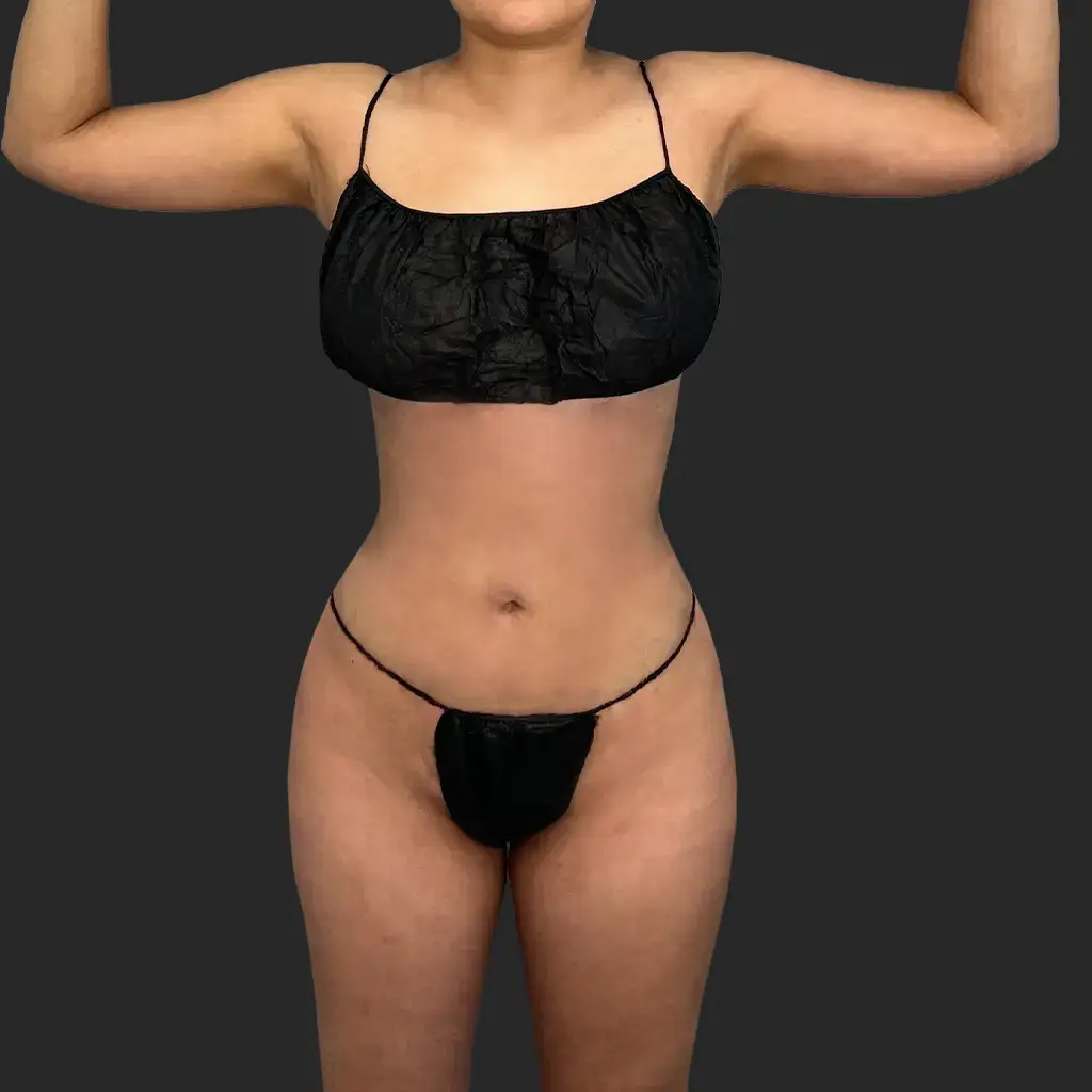 Additional after image