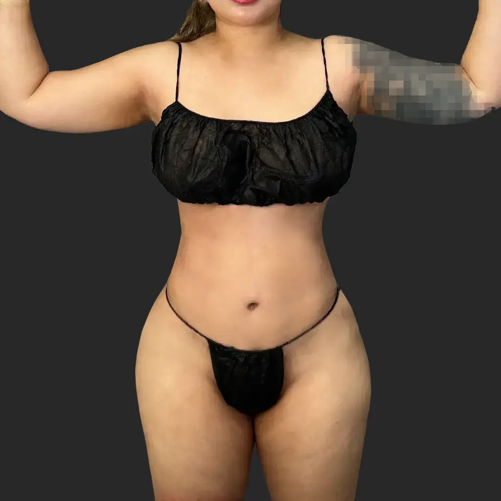 Additional after image