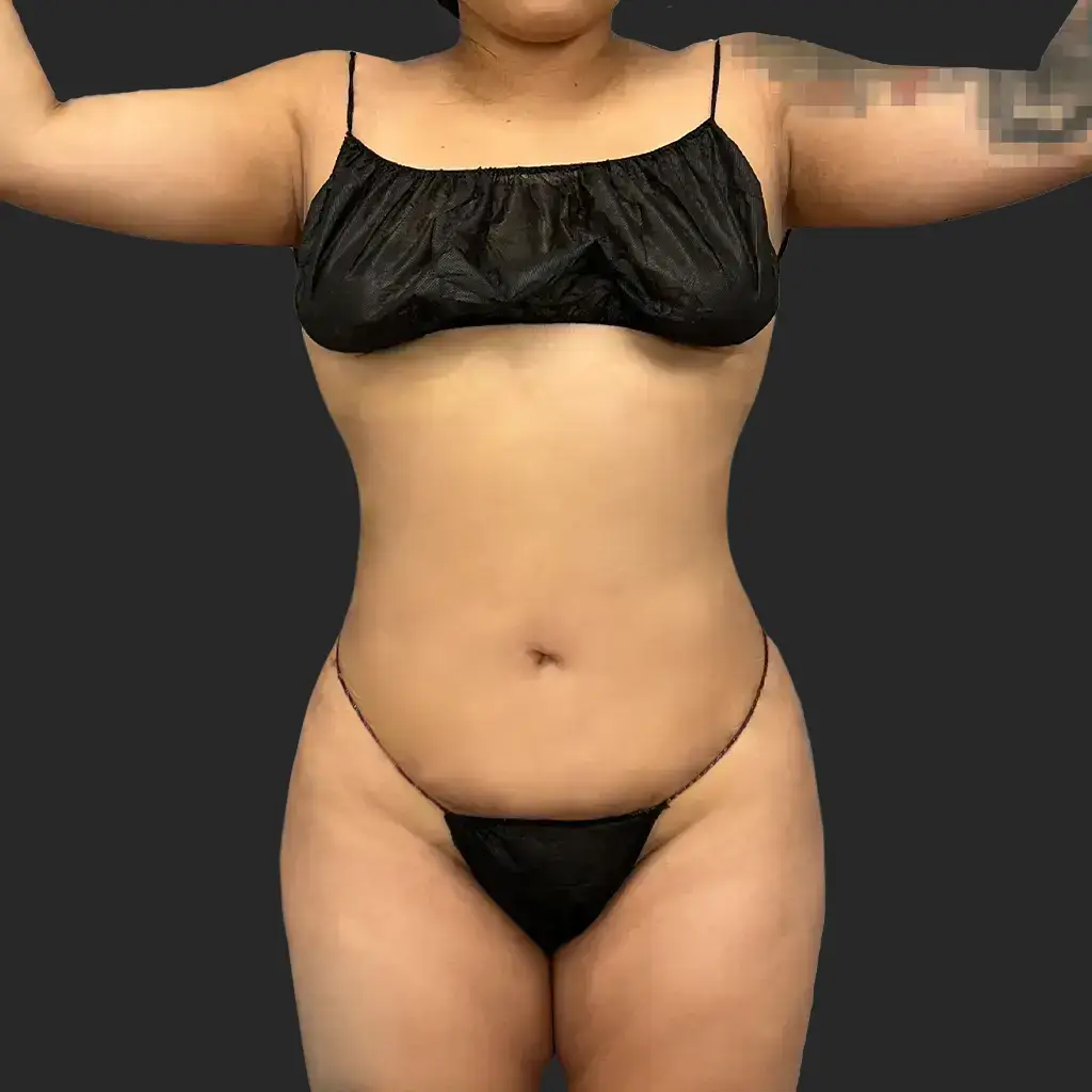 Additional after image