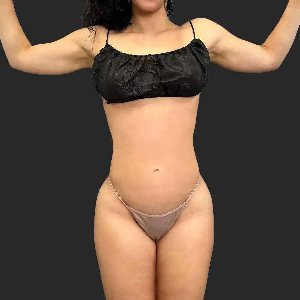 Additional after image