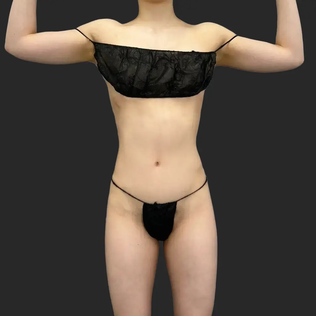 Additional after image