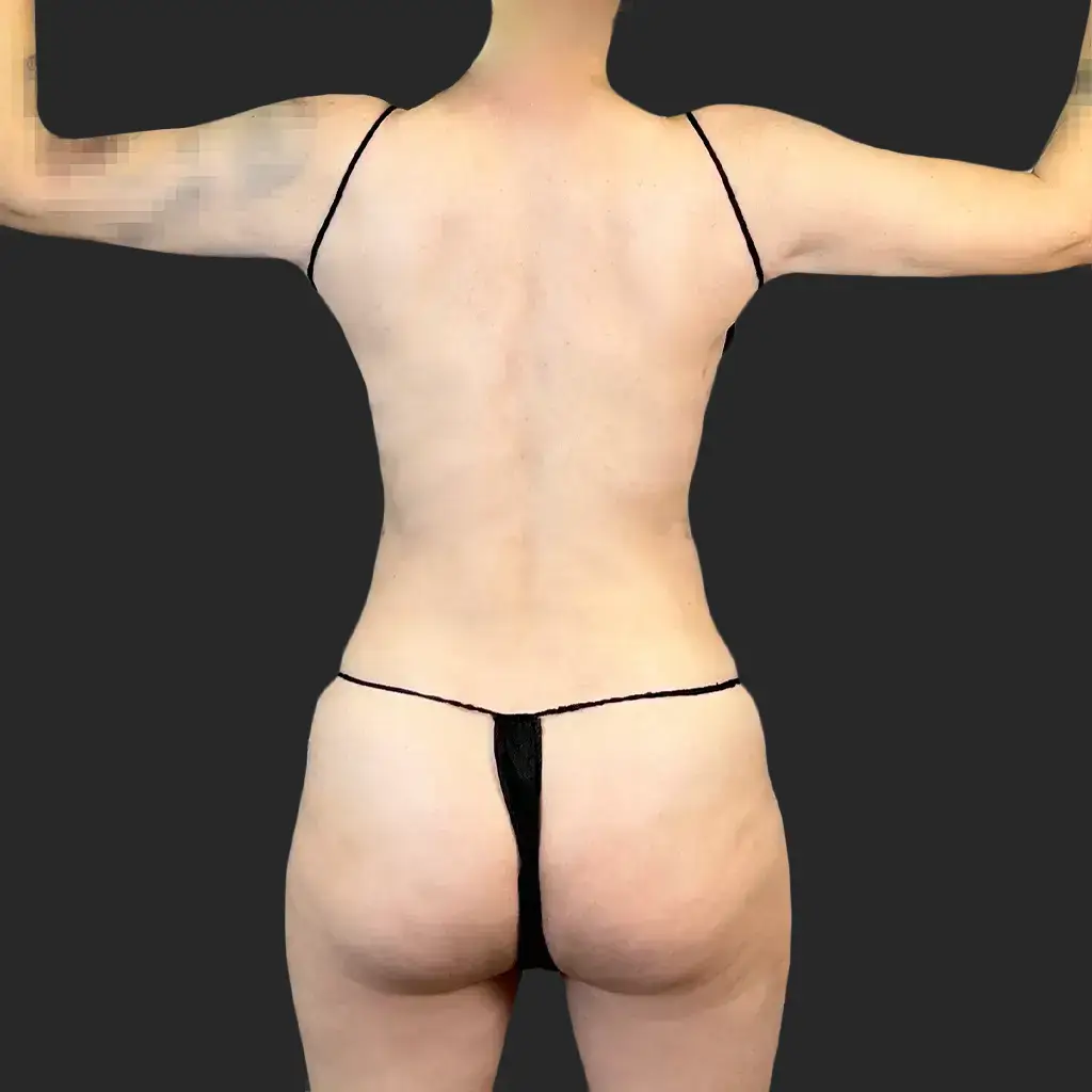 Additional before image