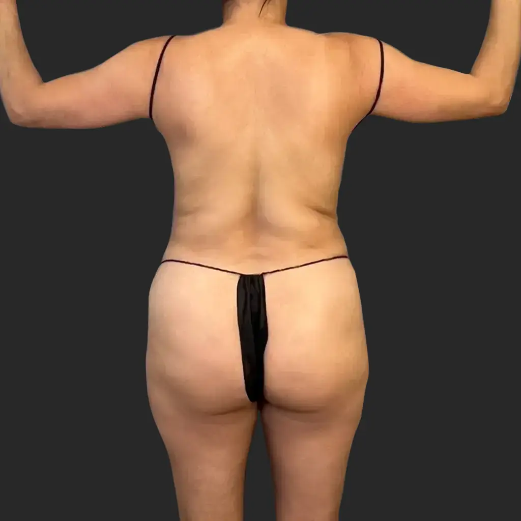 Additional before image