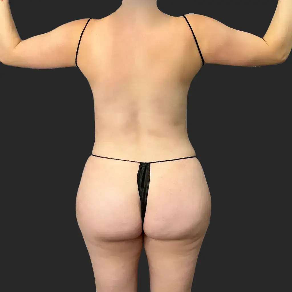 Additional before image