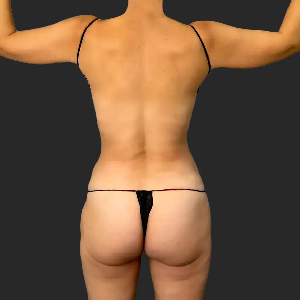 Additional before image