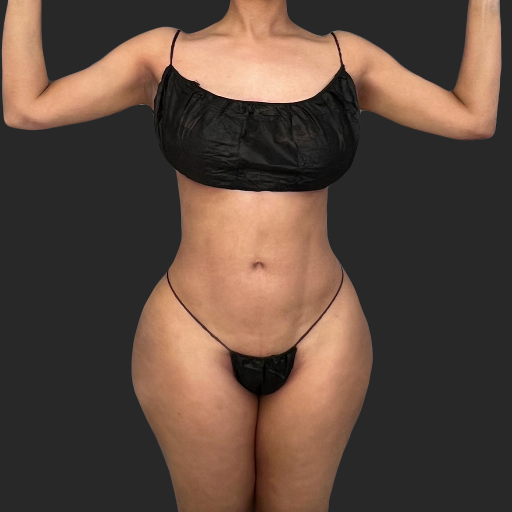Additional before image