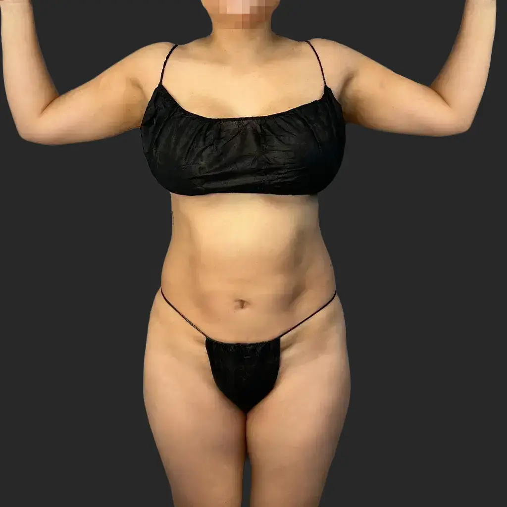 Additional before image