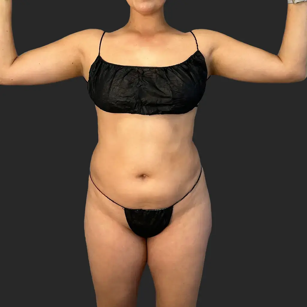 Additional before image