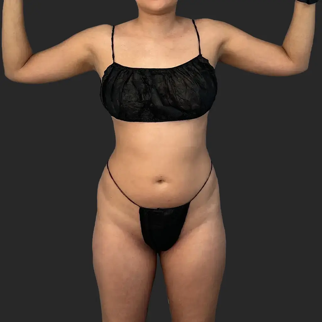 Additional before image