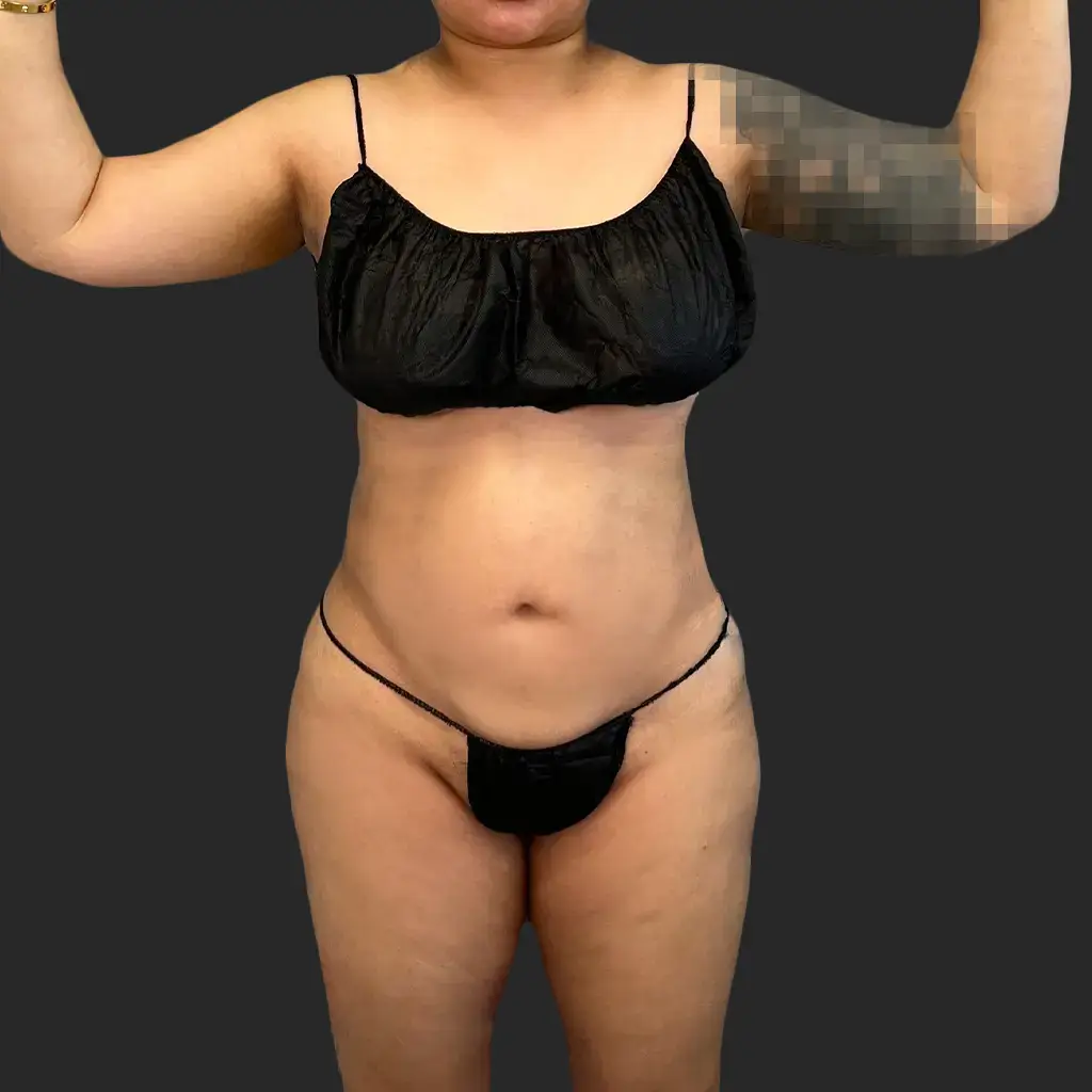 Additional before image