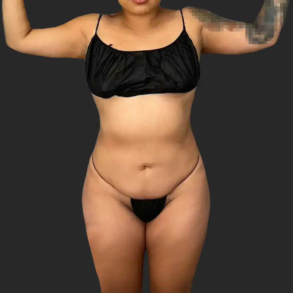 Additional before image