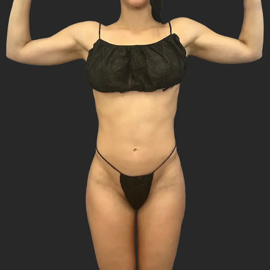 Additional before image