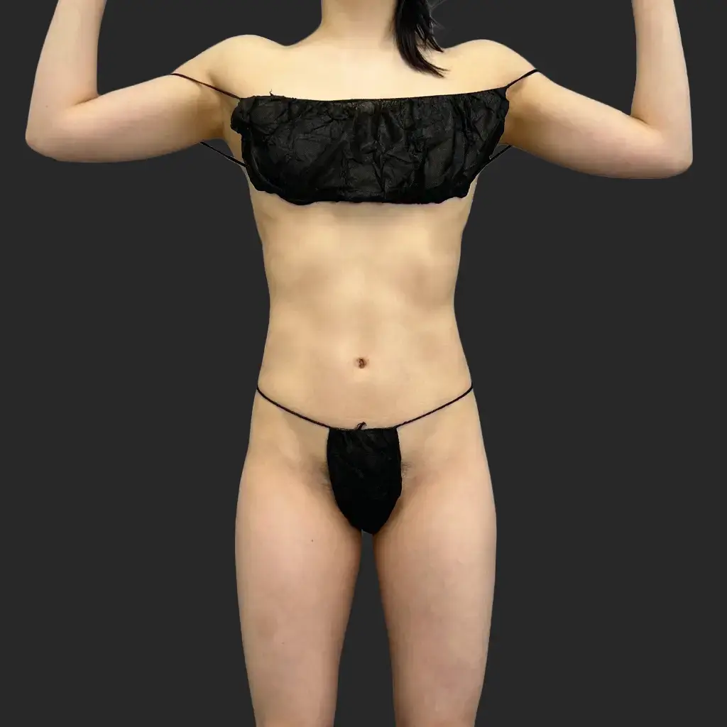 Additional before image