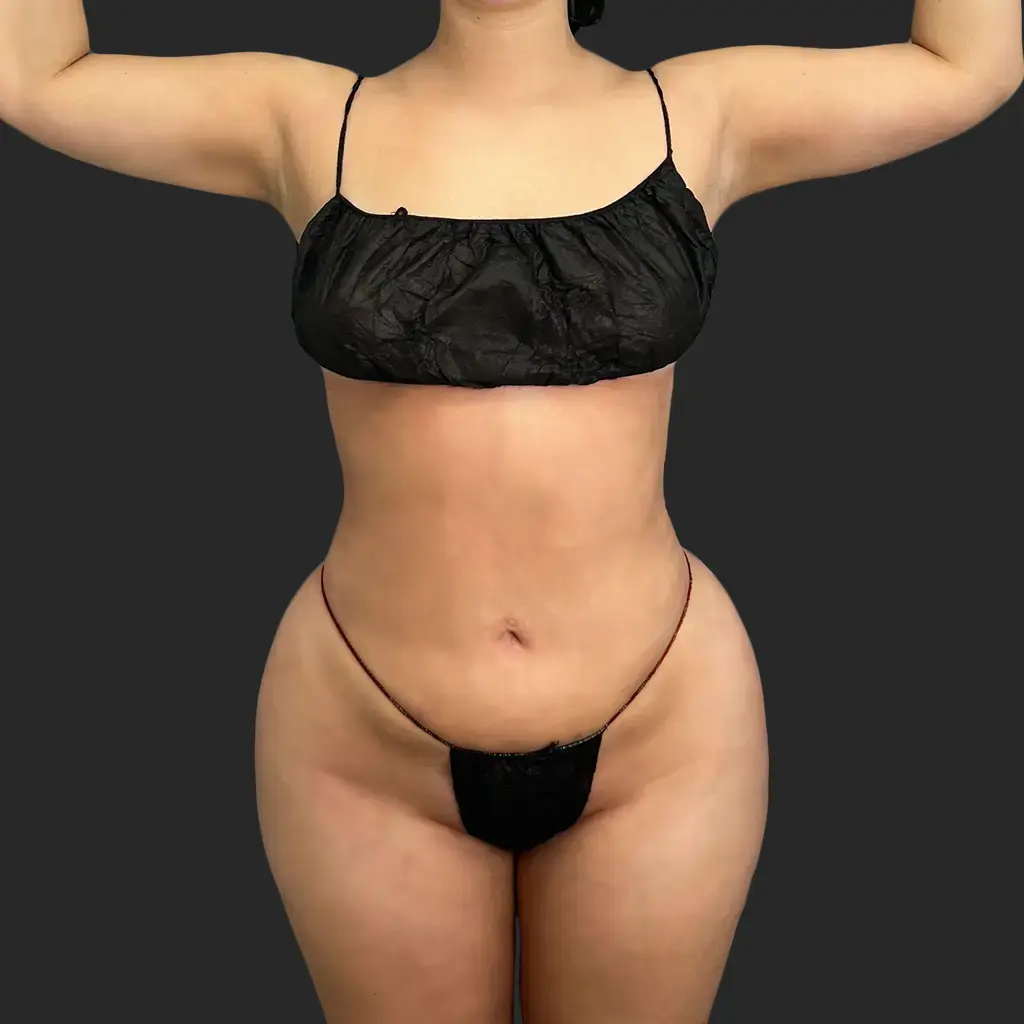 Additional after image