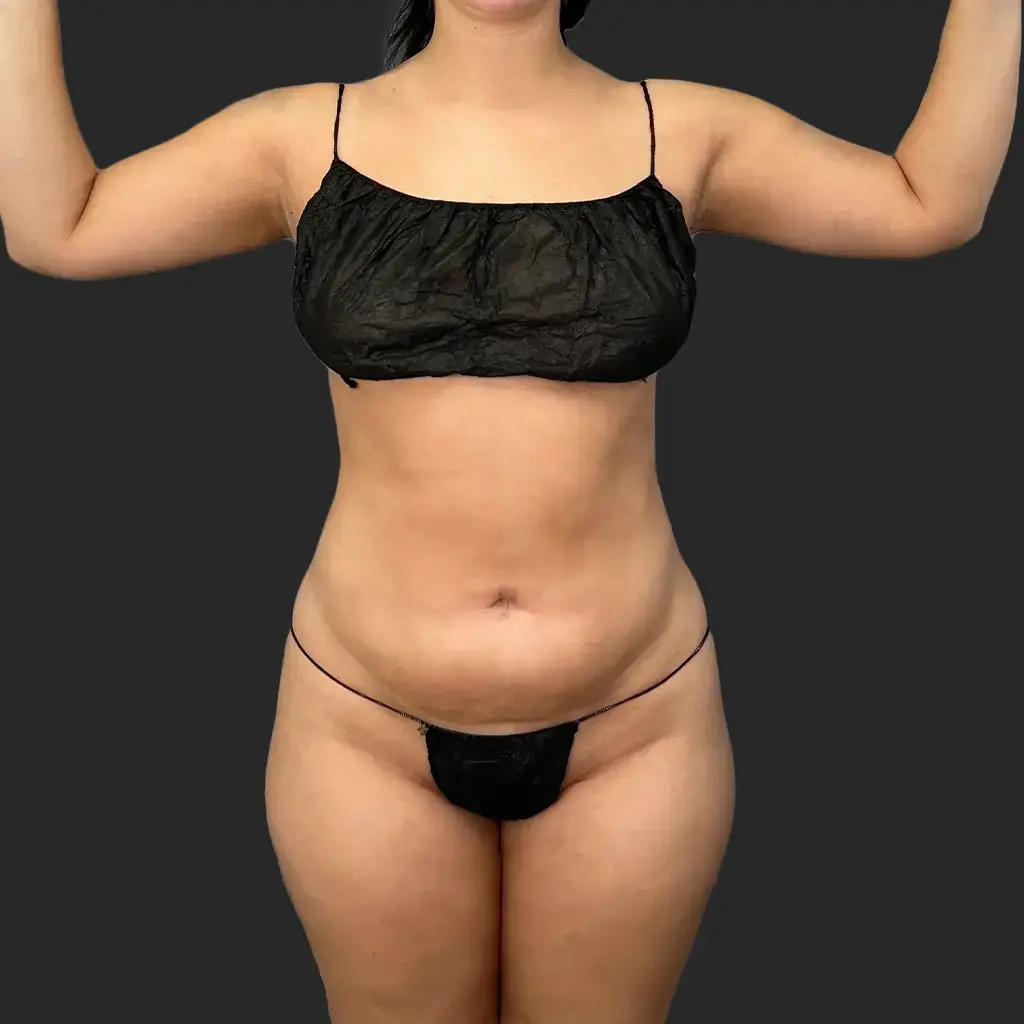 Additional before image