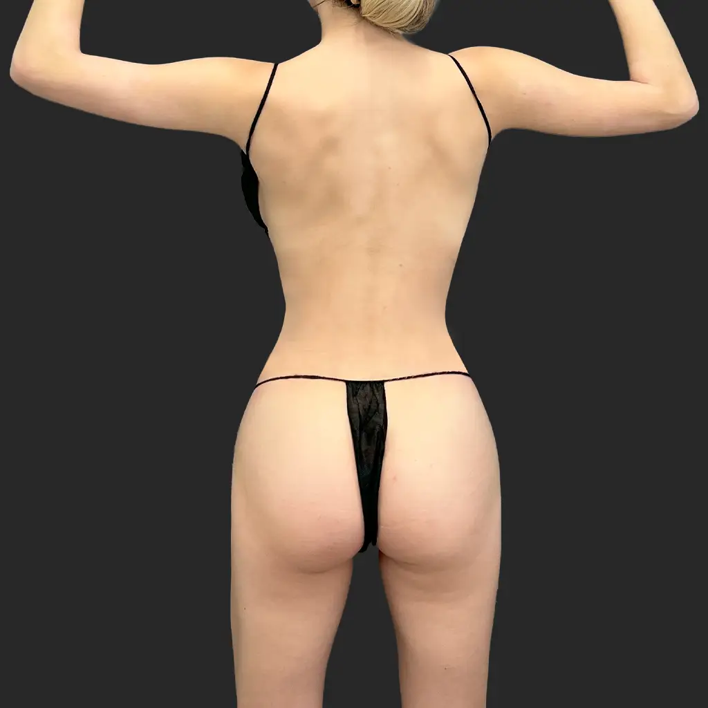 Additional after image