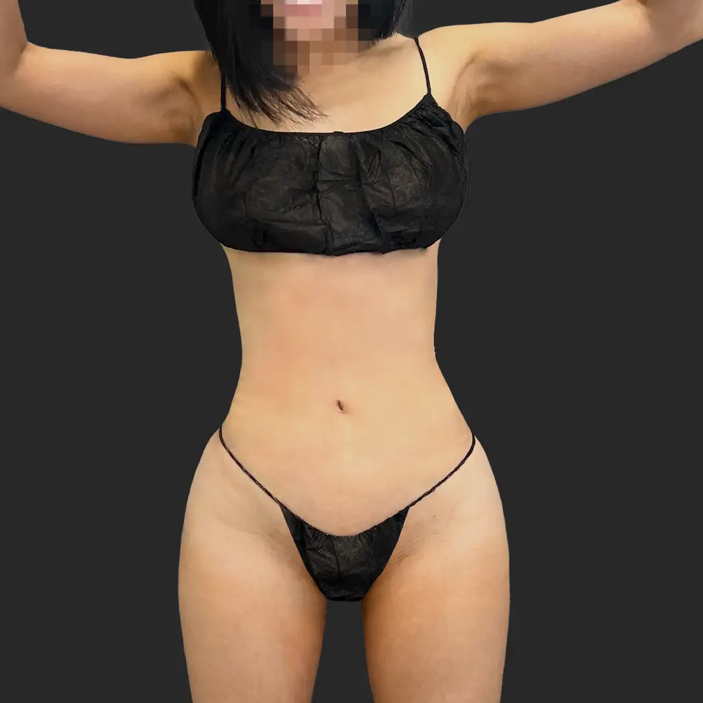 Additional after image