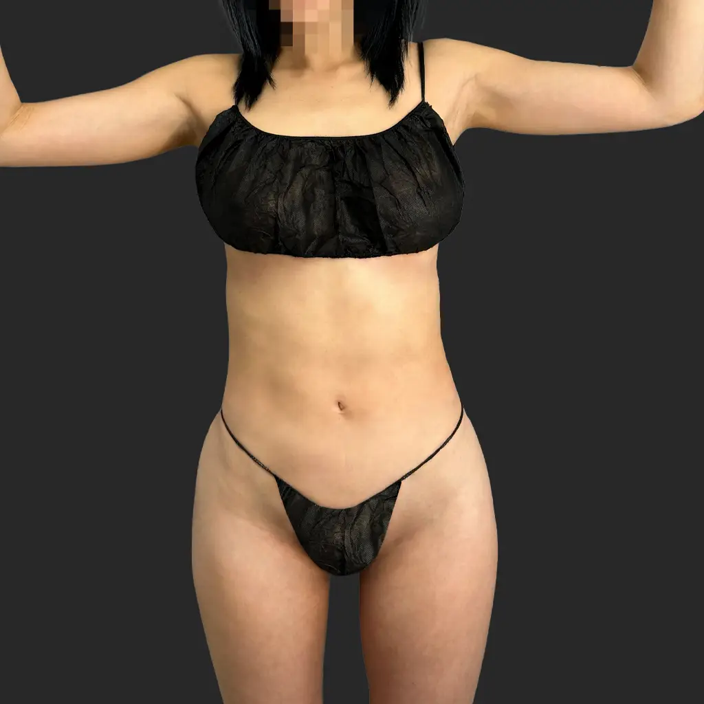 Additional before image